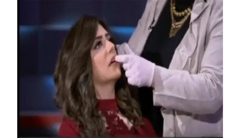 شاهد مذيعة مصرية تحقن شفتيها على الهواء مباشرة