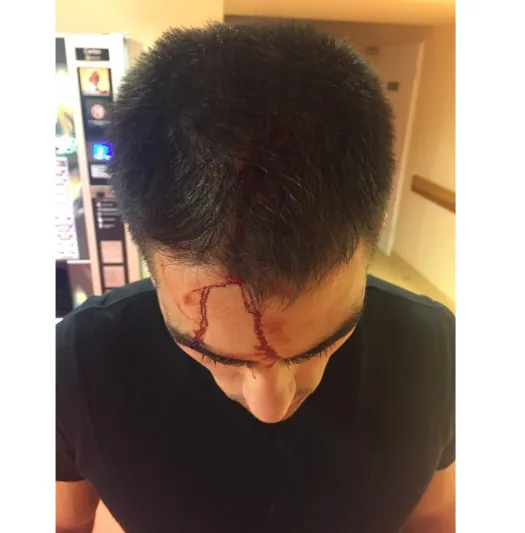 مصري يبرح إسرائيلياً ضرباً فمالسبب