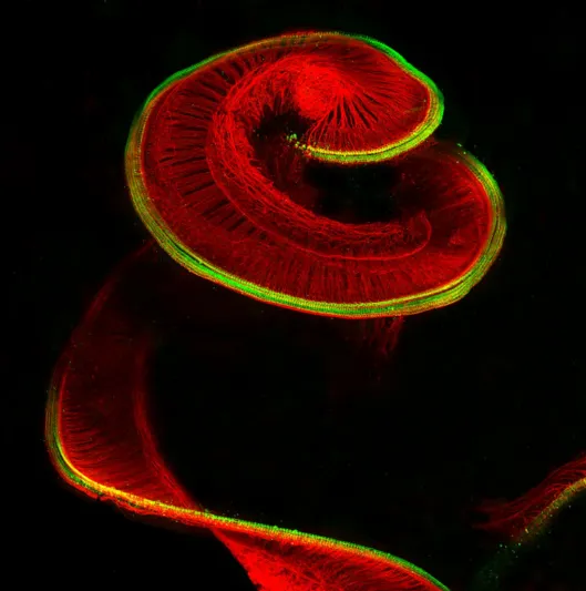 شاهد| أروع الصور المجهرية على الإطلاق