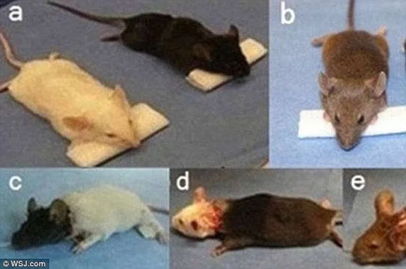 أحدث تطورات أول عملية زراعة رأس بالعالم (فيديو)