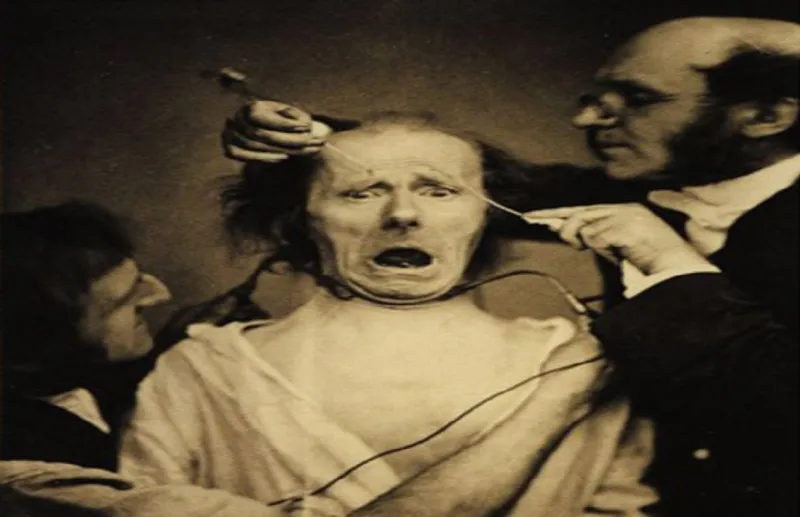 لن تتخيل مدى بشاعتها ..أغرب التجارب الطبيه على البشر (صور)