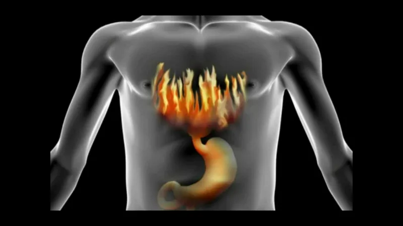 فوائد الموز الأسود لجسمك.. علاج الاكتئاب أهمها