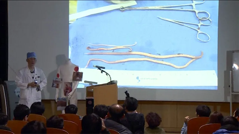 بعد نجاحه في الفرار...مفاجآت في أمعاء الجندي الكوري الشمالي (صور)