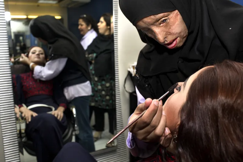 فيديو| مصرية طلبت فسخ خطوبتها فعاقبها بـ «ماء النار»