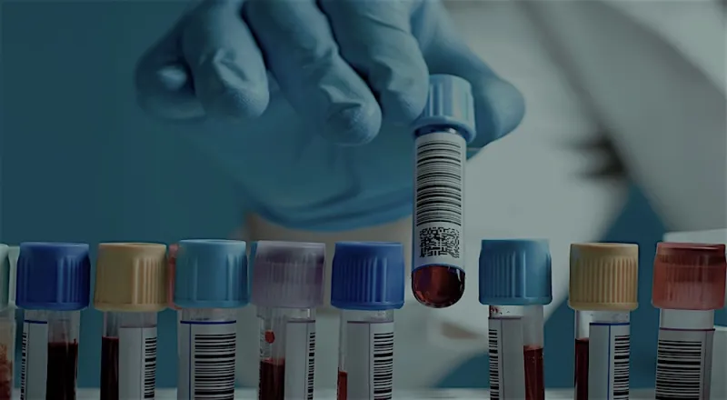 فحوصات ما قبل الزاوج.. هذا ما عليك معرفته (إنفوجراف)