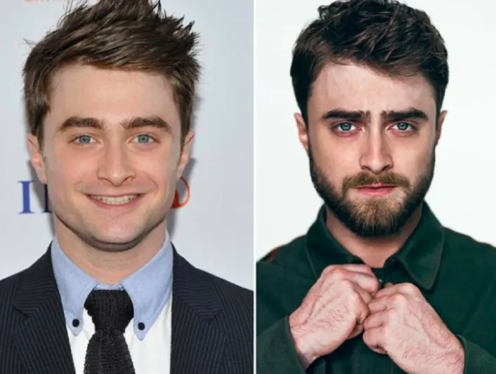 هكذا نقلت اللحية هؤلاء المشاهير من المراهقة إلى النضج (صور)