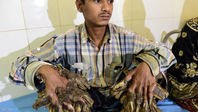 شاهد| كيف تنمو أفرع أشجار في أطراف بنجلاديشي ؟! 