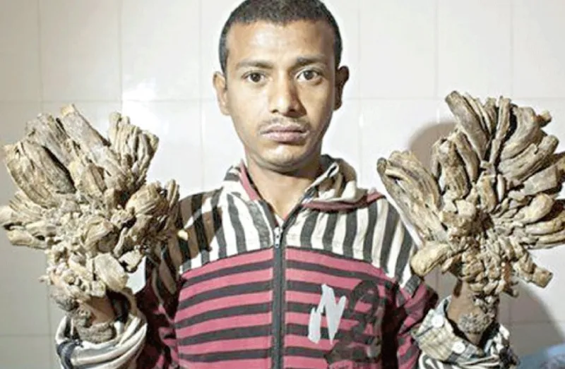 شاهد| كيف تنمو أفرع أشجار في أطراف بنجلاديشي ؟! 