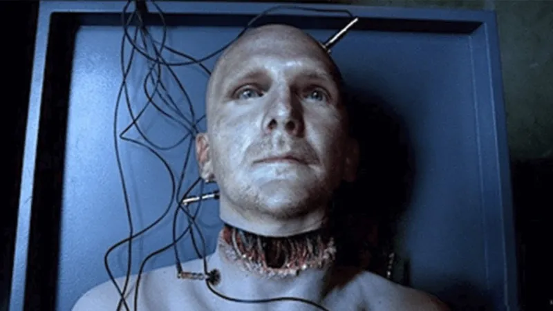 لأول مرة في العالم.. تطوير تقنية لزراعة رأس بشري حي