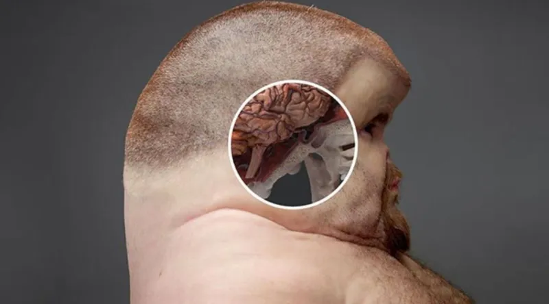 تعرف على «غرام» الرجل الذي لا يموت (صور)