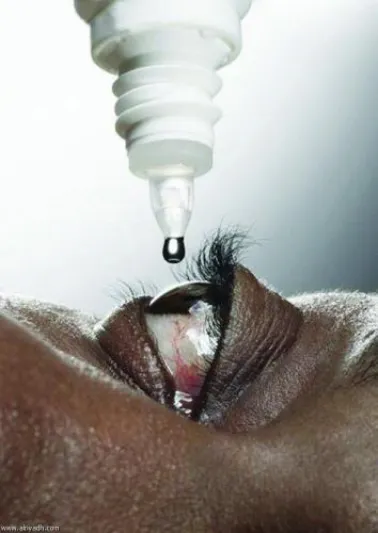 السعودية تحذر من مخاطر تأثير الحرارة العالية ھذا الصيف على صحة العيون