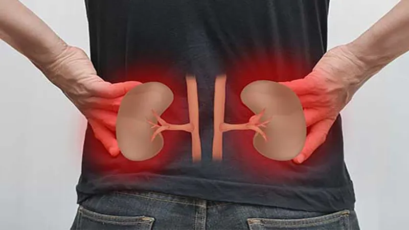 5 مضادات حيوية تتسبب في إصابتك بحصى الكلى