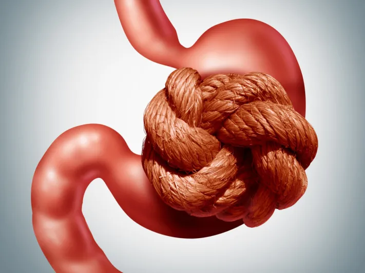 تعرف على أسباب الإمساك وكيفية علاجه