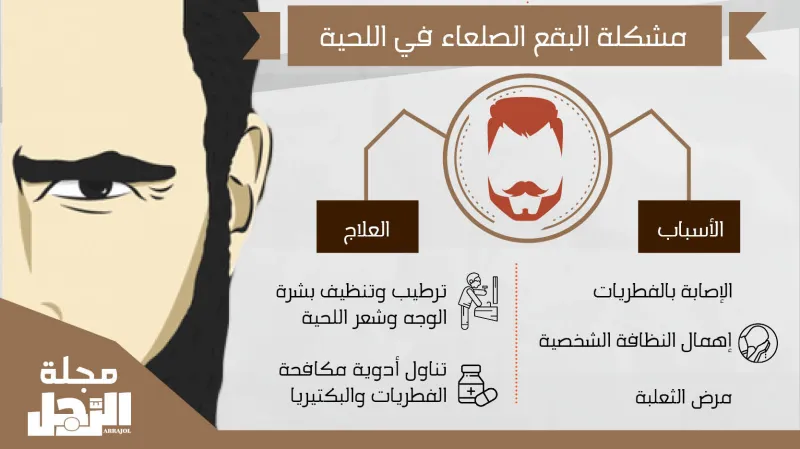إنفوجراف.. أهم مشاكل اللحية وعلاجها 