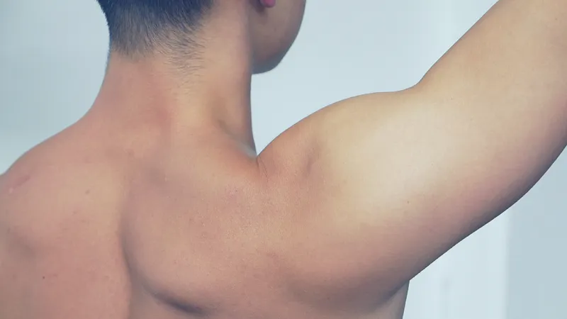 علاج انحناء الكتفين وأسباب انحنائهما للأمام