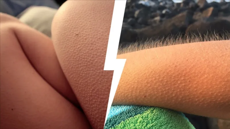 بشرى.. القشعريرة مؤشر للسعادة والصحة الجسدية والعقلية