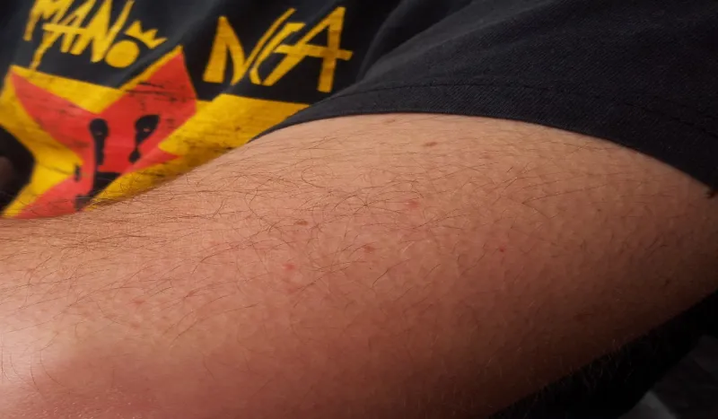 بشرى.. القشعريرة مؤشر للسعادة والصحة الجسدية والعقلية