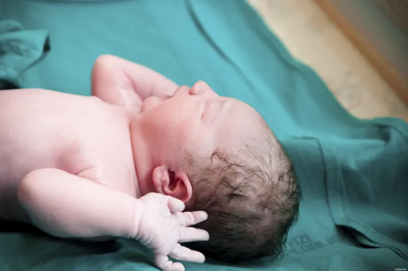 تحدث كل خمسمائة ألف حالة.. إجراء عملية ولادة نادرة لـ" جنين داخل جنين" بالطائف