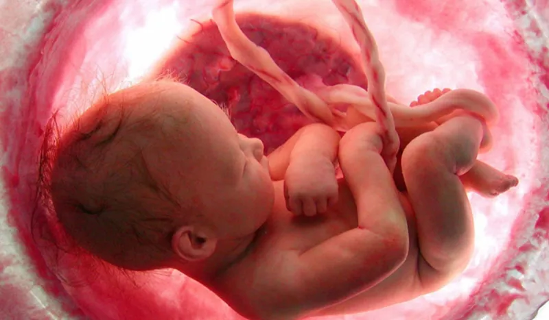 تحدث كل خمسمائة ألف حالة.. إجراء عملية ولادة نادرة لـ" جنين داخل جنين" بالطائف