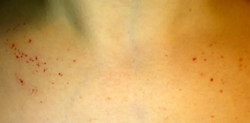 علامات خطرة تدل على وجود مشاكل في جهاز المناعة