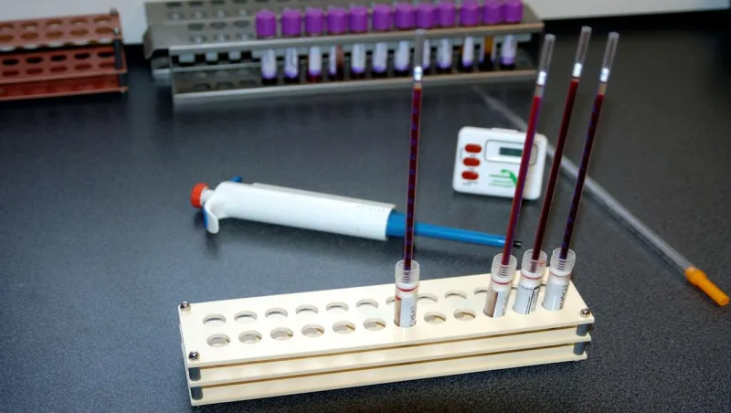 ما هو تحليل esr ومعلومات خطيرة يجب عليك معرفتها