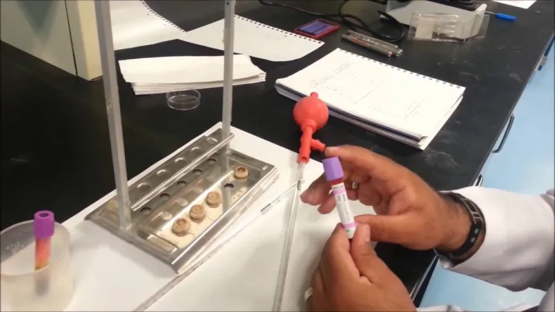 ما هو تحليل esr ومعلومات خطيرة يجب عليك معرفتها