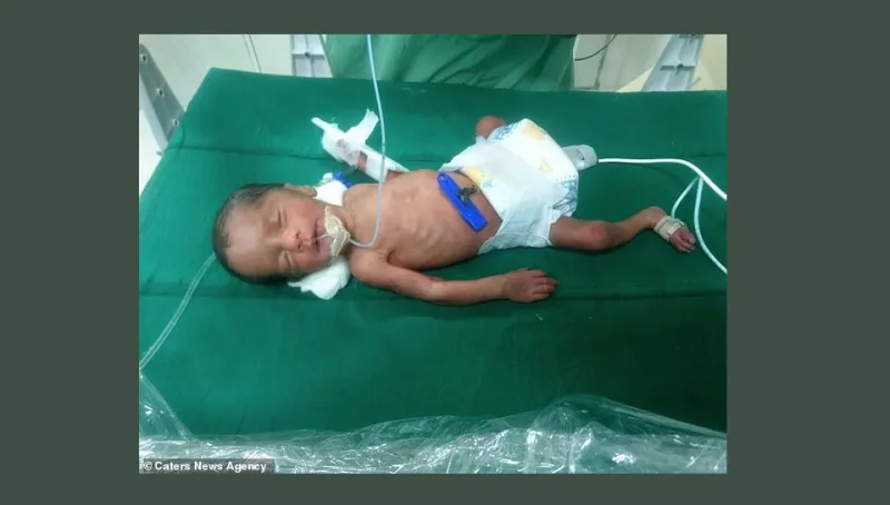 أطباء يزرعون رحم أم في ابنتها للمرة الأولى في آسيا.. هكذا كانت النتيجة (صور)