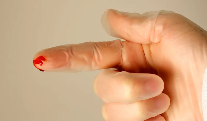 فقدان الوعي عند رؤية الدم ينزف.. ليست حالة نفسية فقط