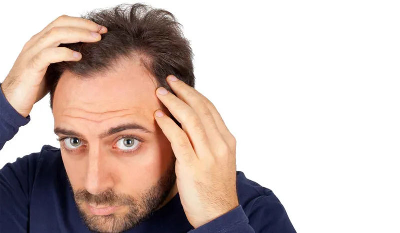 نسب نجاح عالية.. تكلفة زراعة الشعر في مصر 2019