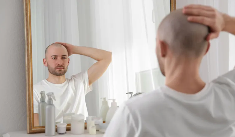 نسب نجاح عالية.. تكلفة زراعة الشعر في مصر 2019