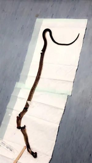 فيديو| لحظات وقوع الكارثة.. أشهر حوادث هجوم الأفاعي في السعودية