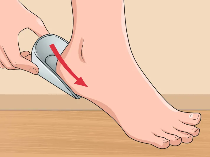 أسباب آلام أسفل القدم