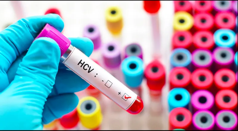 التهاب الكبد الوبائي.. الأعراض وطرق العلاج 