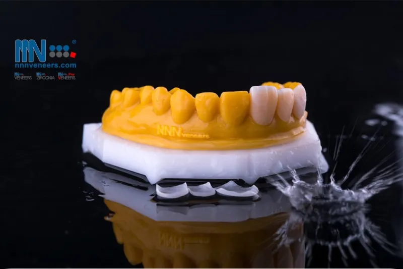 الإمارات الأولى عربيًا والثانية عالمياً في تركيبات وتجميل الأسنان