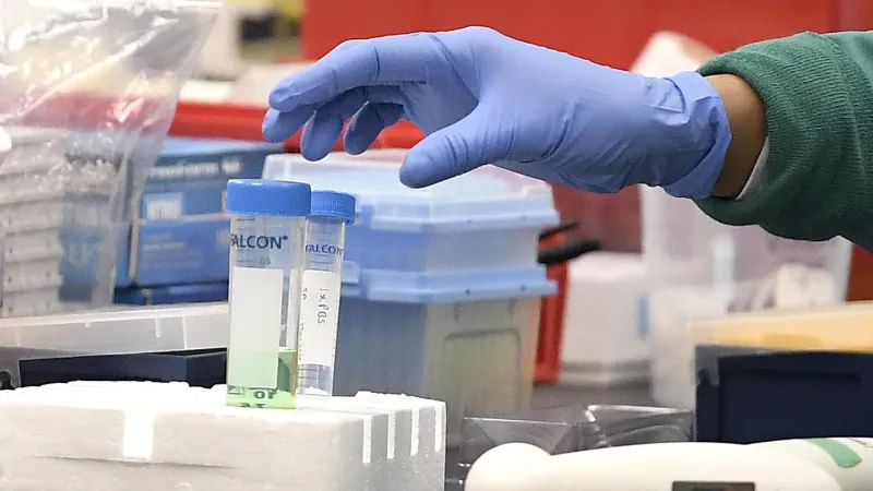 أرقاماً خيالية..كم تبلغ أرباح لقاح كورونا؟