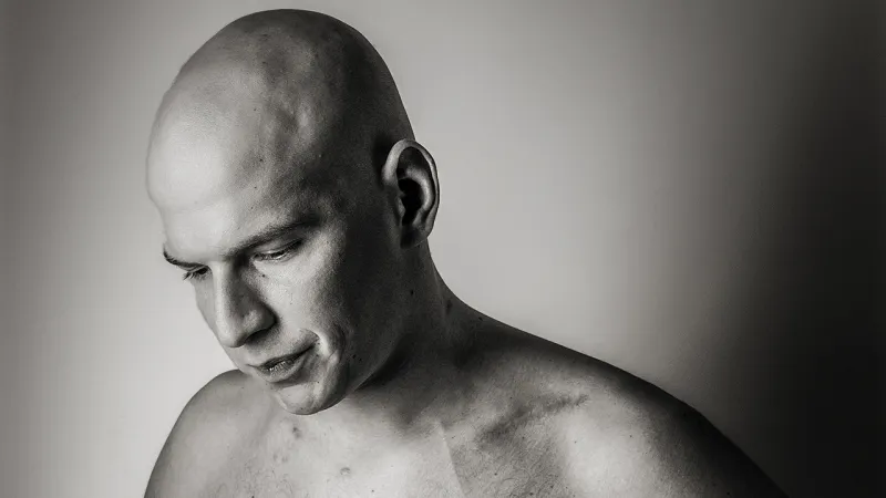 اكتشاف مرض مميت يصيب الرجال فقط..تعرف على أعراضه