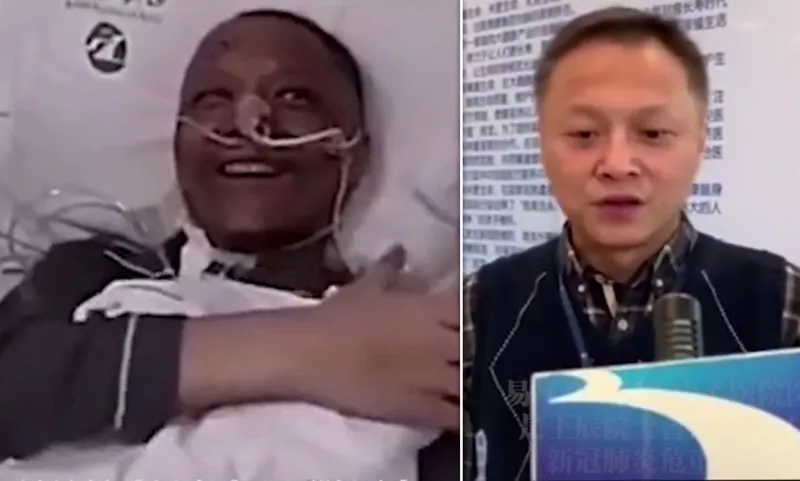 شاهد كيف أصبح طبيب ووهان الذي تغير لون بشرته بعد إصابته بكورونا