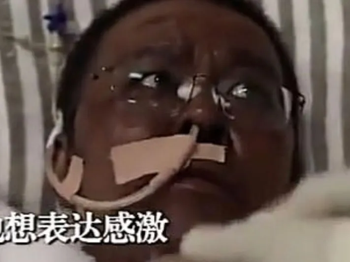 شاهد كيف أصبح طبيب ووهان الذي تغير لون بشرته بعد إصابته بكورونا