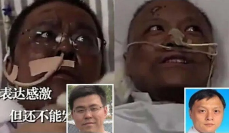 شاهد كيف أصبح طبيب ووهان الذي تغير لون بشرته بعد إصابته بكورونا