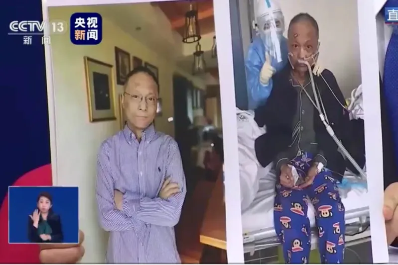 شاهد كيف أصبح طبيب ووهان الذي تغير لون بشرته بعد إصابته بكورونا