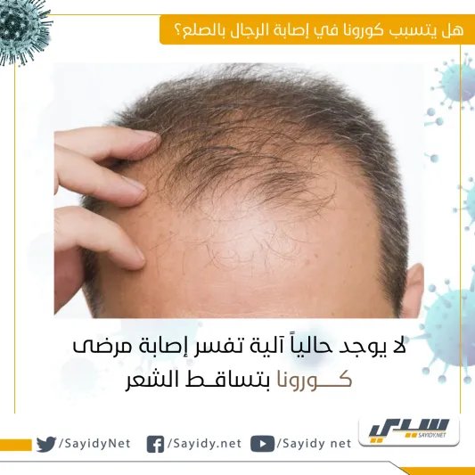  انفوجراف| هل هناك علاقة بين الصلع والإصابة بكورونا؟