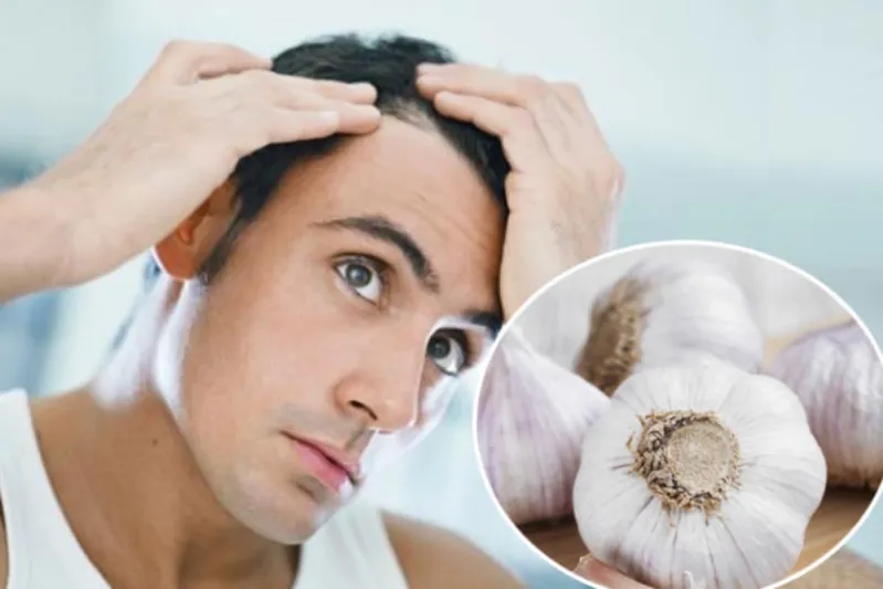 فوائد الثوم وكيفية التغلب على رائحته الكريهة
