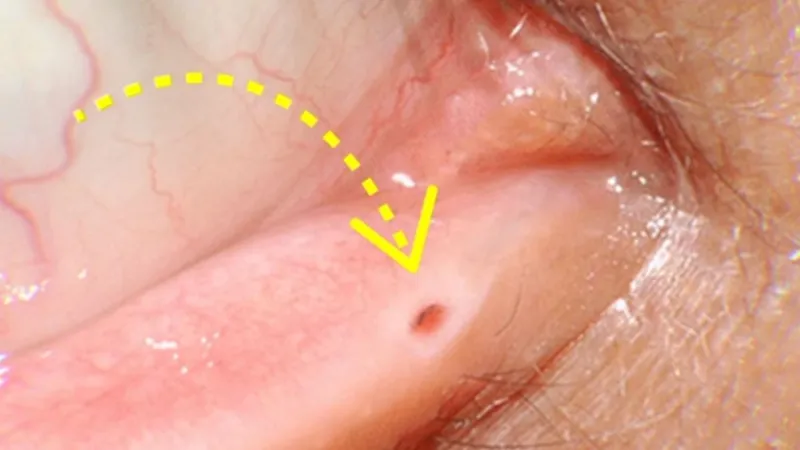 ما أهمية الثقب الصغير الموجود في زاوية جفنك؟ هل سبق ولاحظته؟