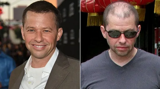 صور| نجوم هوليوود مشهورون بالشعر المستعار