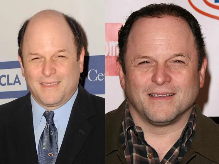 صور| نجوم هوليوود مشهورون بالشعر المستعار