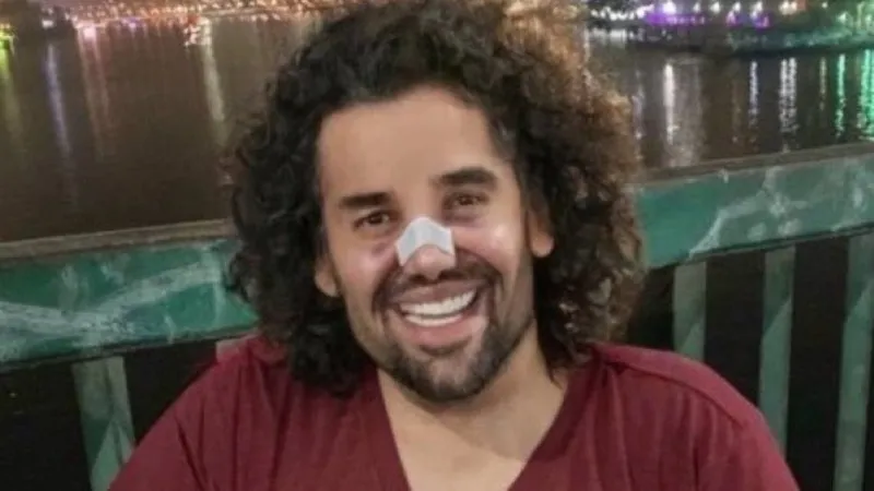 صورة صادمة متداولة.. هل خضع حسين الجسمي لعملية تجميل؟