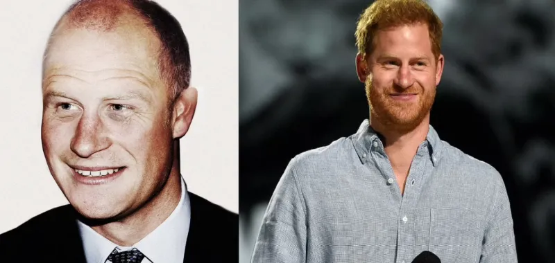 هل سيصبح الأمير هاري أوسم رجل أصلع في العالم؟ شاهد واحكم بنفسك (صور)
