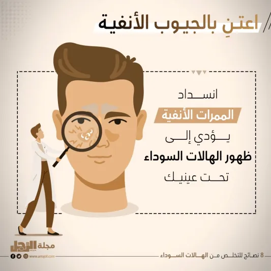 8 نصائح للتخلص من الهالات السوداء