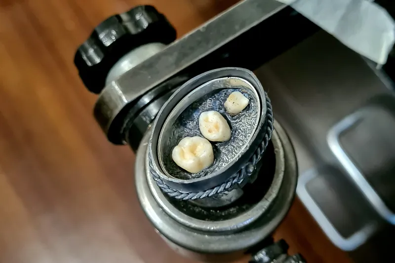 فتاة تصنع المجوهرات من أسنان ورفات الموتى! (صور)