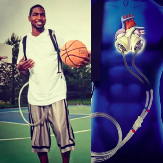 كيف عاش شاب 18 شهراً بلا قلب؟ (فيديو) 